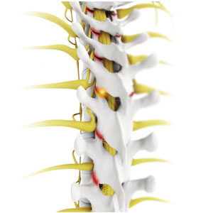 Facet Joint Block