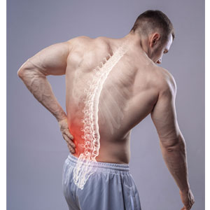  Low Back Pain